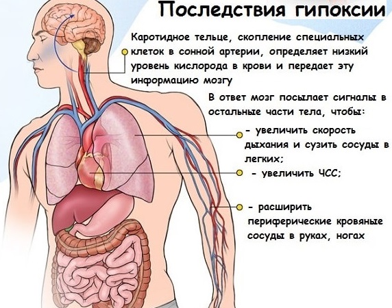 Гипоксия, Что такое Гипоксия, виды и классификация гипоксии