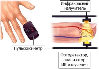 Какой палец отрубали ассасинам